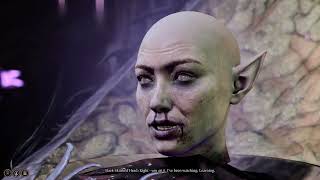 Baldur’s Gate 3: All 8 Brain Jar Cutscenes (Slack-Skinned Head)