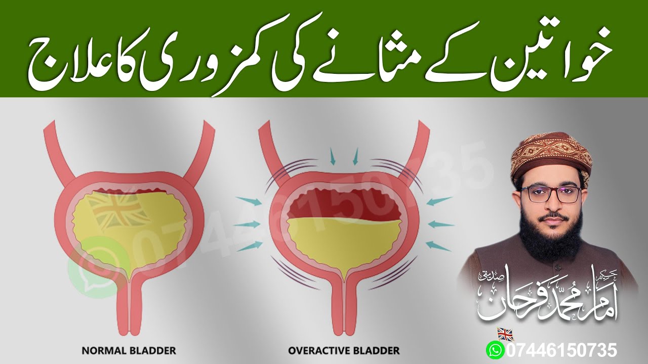Bladder Weakness in Women? Causes & Treatment | Urine Leakage & Incontinence | Urdu/Hindi Guide