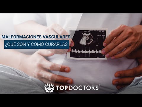 Malformaciones vasculares ¿Qué son y cómo curarlas?