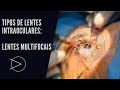 Tipos de lentes intraoculares : Lentes multifocais