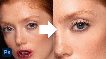 Remove Eye Bags / Dark Circles | Photoshop