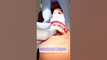 Временный зубной протез.Temporary denture. Implantation.