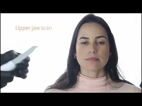 Escanner intraoral3Disc  - Escaneado estandar de mandíbulas