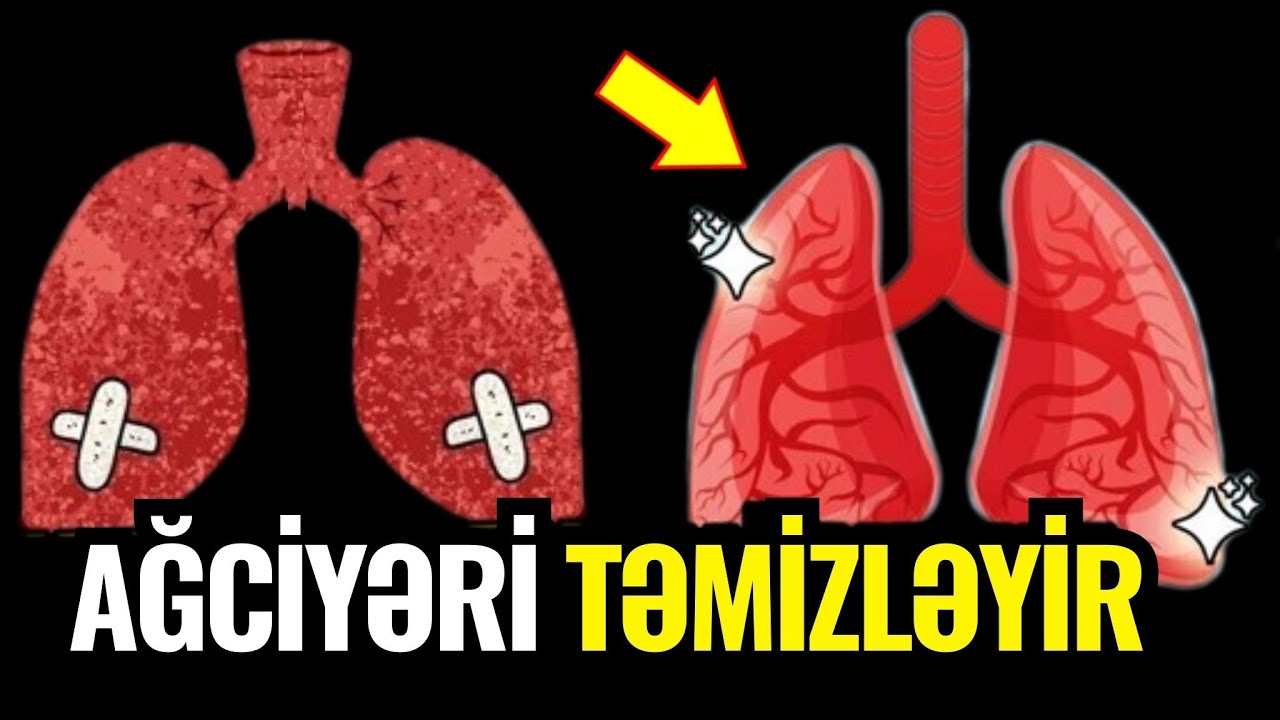 Ağciyəri 3 günə Təmizləyən 4 Möcüzəvi bitkilər