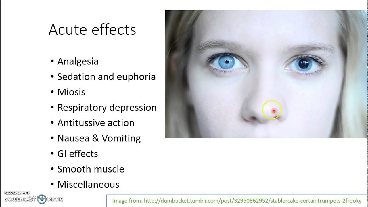 Opioid analgesics II - YouTube