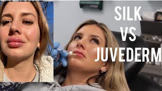 Trying Silk Lip Injections Juvederm Vs Silk