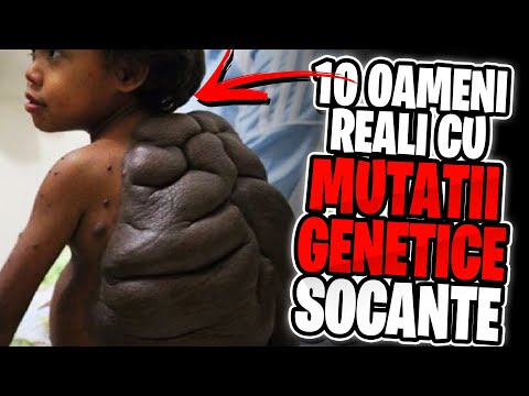 10 Oameni Reali cu Mutatii Genetice Socante