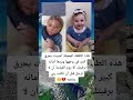 هذه الطفله الجميله أصيبت بحرق كبير في وجهها ويدها أمانه برقبتك الا يوم القيامة أن لا ترحل 