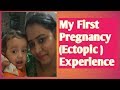 My First Ectopic Pregnancy Experience /Ectopic pregnancy के बारे में सब कुछ जाने