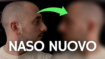 Quanto costa rifarsi il naso uomo?