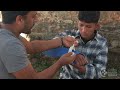 Splinting a Broken Bone (French) - Emergency Care Series