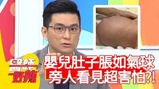 嬰兒肚子脹如氣球，旁人看見超害怕？！【醫師好辣】20210125 part4 EP1089 陳榮堅 何妤玟