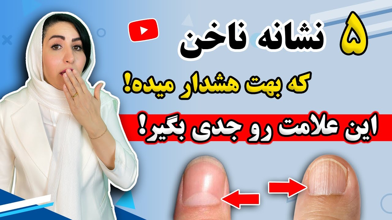 نشانه های هشدار برای کسانی که خطوط عمودی یا علامت ماهک روی ناخن دارند! | درمان خطوط ناخن