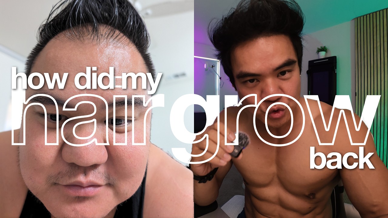 I Lost 100 lbs and My Hair Grew Back — Transcript