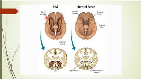 1203 Learning memory amnesia