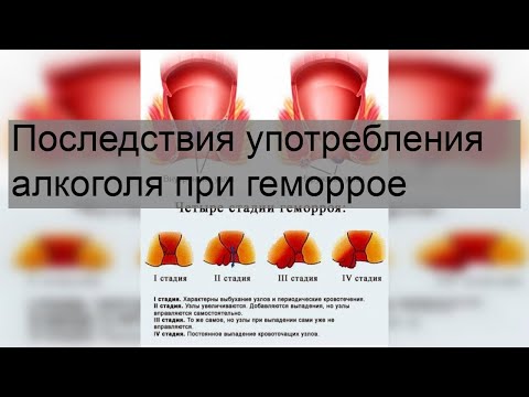 Последствия употребления алкоголя при геморрое