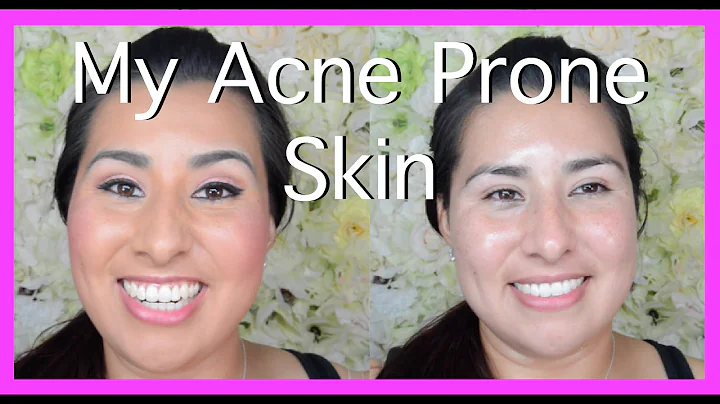Get Unready With Me / Skin Care Routine for Acne Prone Skin (DRUGSTORE)