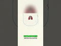 Lung Collapse Explained: How Chest Tubes Restore Vacuum #shorts