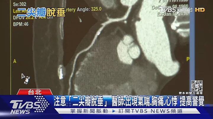 “二尖瓣脱垂”发生关键在于这两大因素...医:轻忽恐致命!｜十点不一样20220705 - 天天要闻