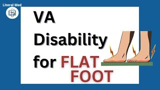 Va Disability Compensation For Flat Feet - Pes Pl