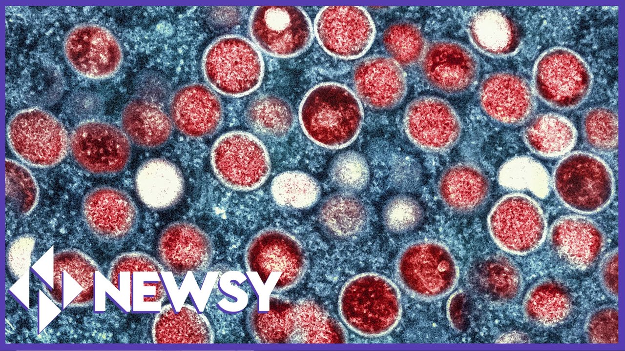 World Health Organization Looks To Change Monkeypox Name