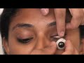 Artificial eye removal with suction cup