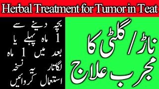 Herbal Treatment for Tumor in Teat || تھن میں سے ناڑگلٹی ختم کرنے کا ہربل علاج