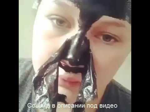 Лучшая маска против черных точек