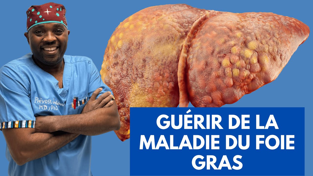 Guérir de la maladie du foie gras - Tout comprendre par  @Docteur Sourire