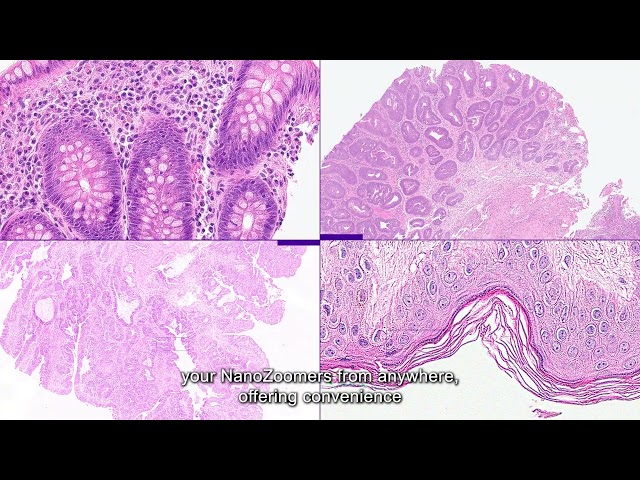 Introducing the NanoZoomer S540