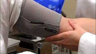 Proper placement for the SunTech Medical Orbit K blood pressure cuff