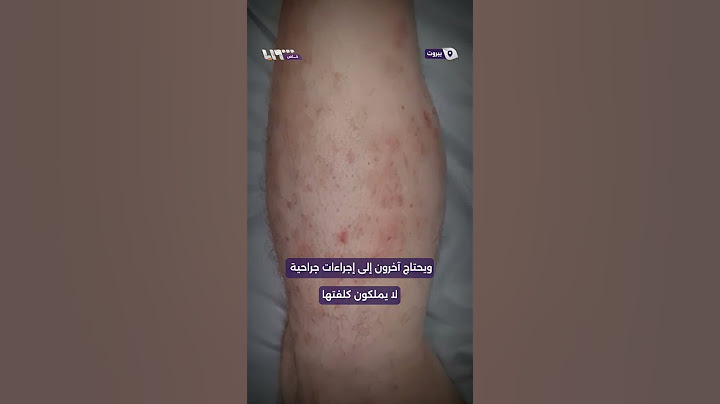 سجناء رومية السوريون يطلقون صرختهم عبر تلفزيون سوريا