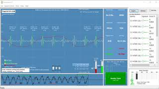 Wireless Contactless Vital Sign and Biometric Technologies