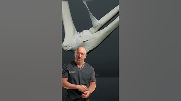 Most Common Biceps Muscle Tear #shorts