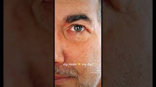 Heterochromia At Its Finest