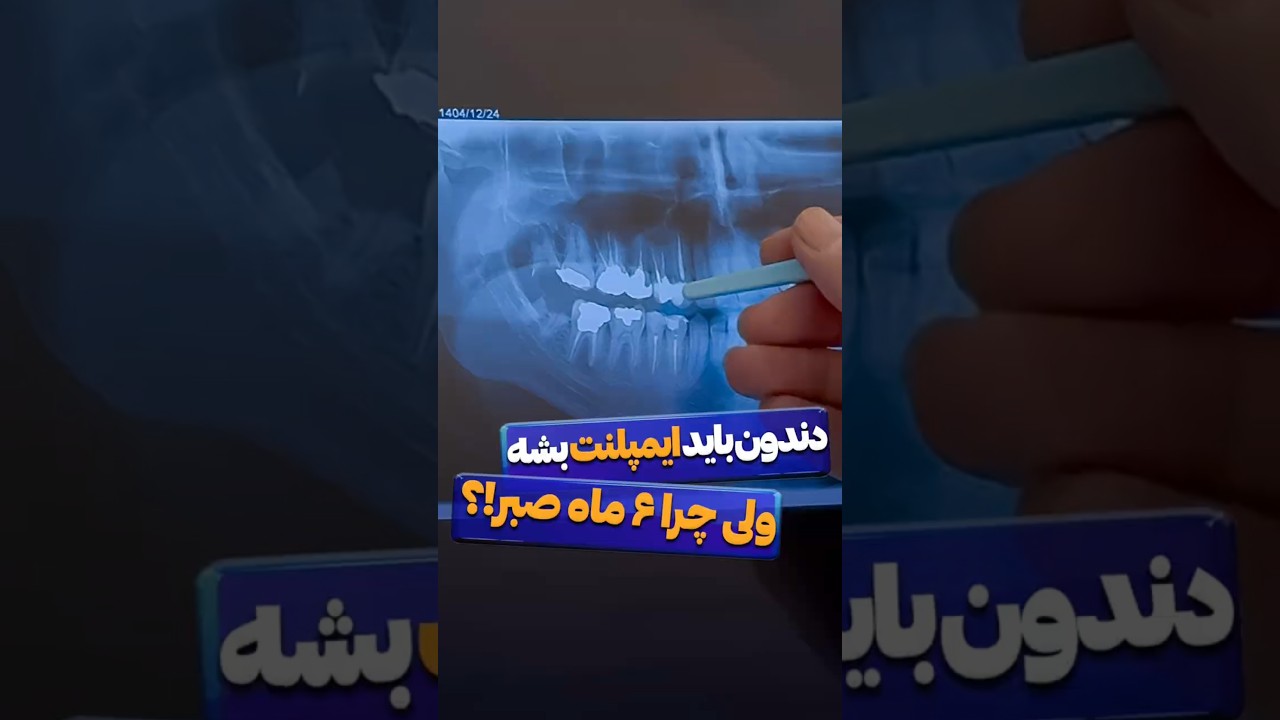 کاور ویدیوی یوتیوب