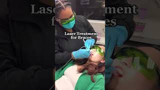 Braces Laser Treatment💥👀