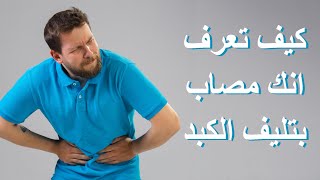 كيف تعرف انك مصاب بتليف الكبد