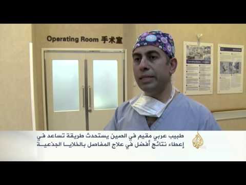 طبيب عربي بالصين يستحدث علاجا للمفاصل بالخلايا الجذعية