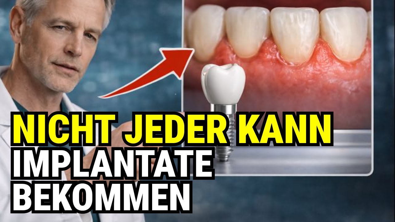 Implantate nach 40: Wer sollte NICHT riskieren