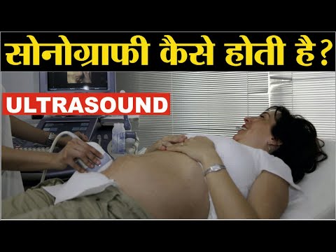 वीडियो: सोनोग्राम कैसे किया जाता है?