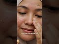 Stop the Itch! 🚫🦟 How to Repair Your Skin Barrier Fast! 🛡️✨