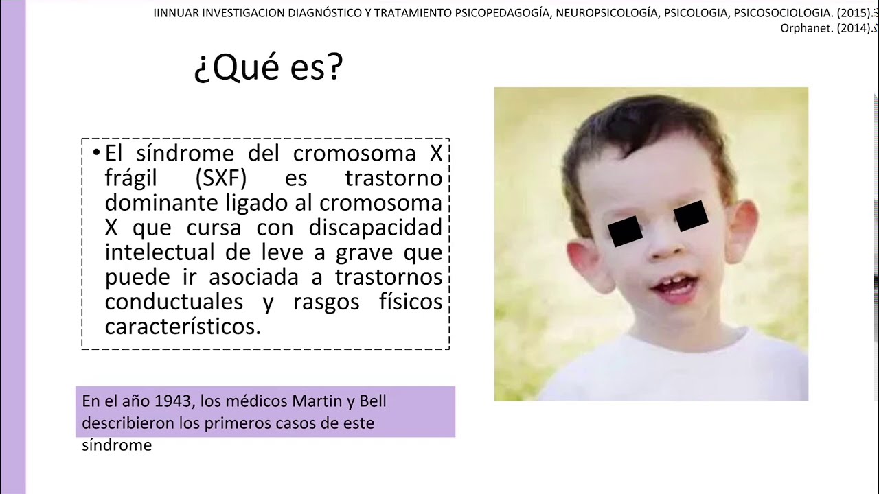 Síndrome de X frágil