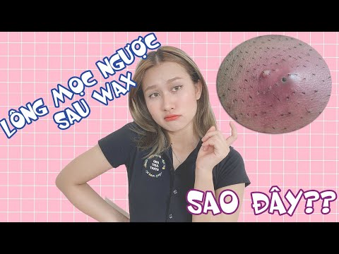 LÔNG MỌC NGƯỢC VÀO TRONG SAU WAX? LÀM THEO MÌNH ĐỂ WAX LÔNG KHÔNG CÒN LÀ NỖI LO 💛 | CHLOE DO