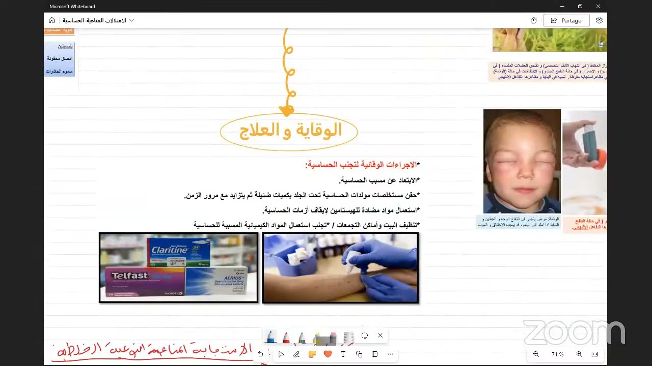 مراجعة العلوم النهائية الحصة التاسعة س4م -الحساسية والعون المناعي