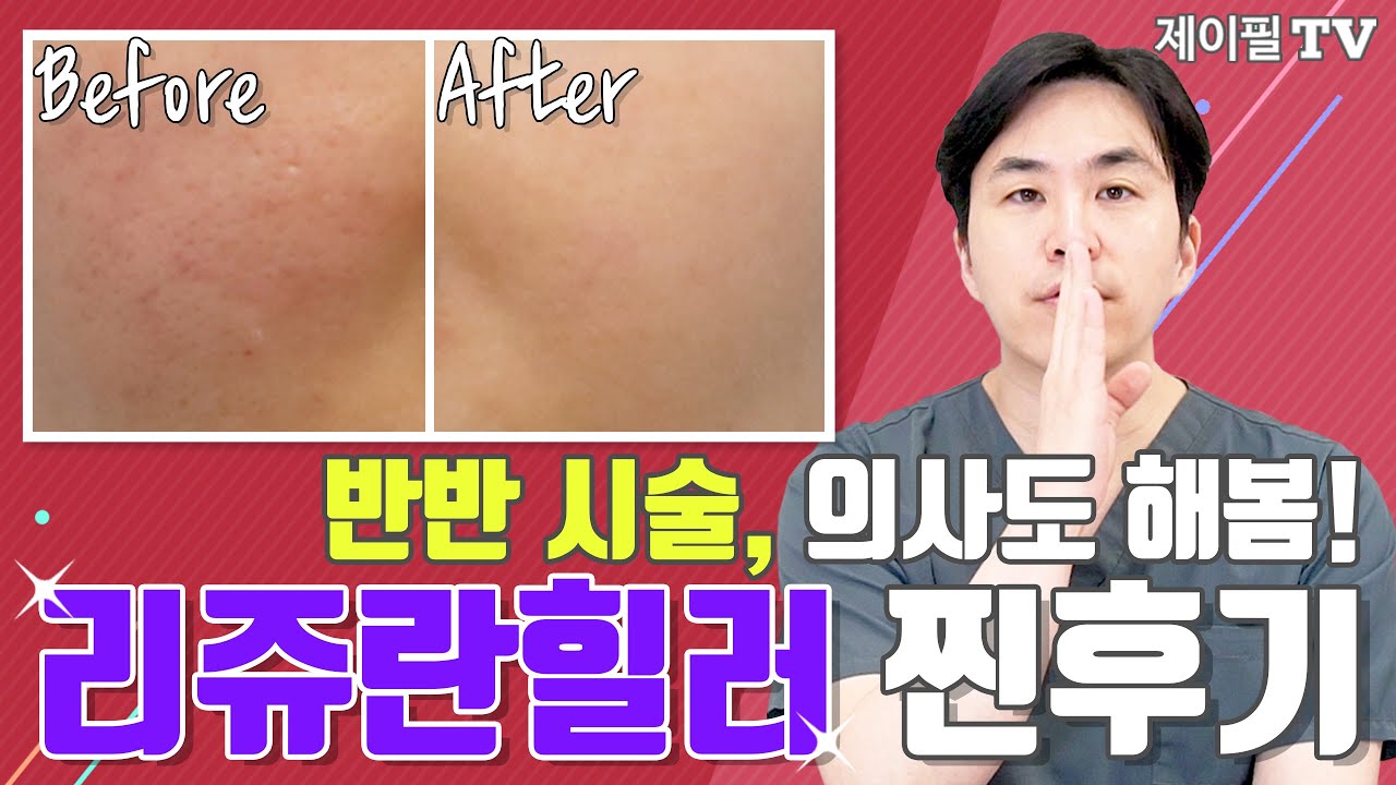리쥬란힐러! 의사가 직접 맞아봤습니다
