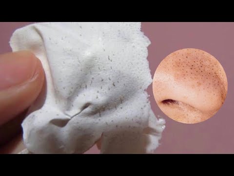 Cerotti anti punti neri fai da te | Skincare Routine | AlicelikeAudrey