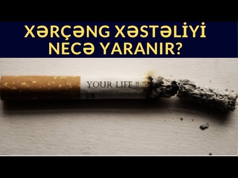 Video: Qoç Növünü Necə Tapmaq Olar