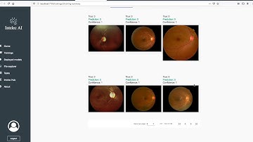 Blindness detection with Intelec AI v3