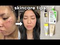 skincare tips i wish i knew SOONER 💡 acne, sensitivity, insecurities | chit chat grwm